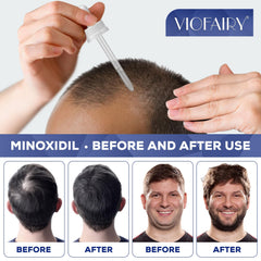 5% Minoxidil for Men and Women, Hair Regrowth Treatment for Thinning Hair and Hair Loss, Topical Solution - 3 Months Supply - Dermatologist recommended (Pack of 3)