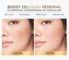 L’Oréal Paris Glycolic-Bright Glowing Peeling Toner