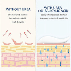 40% Urea Cream for Dry Foot, Cracked & Scaly Skin Moisturizing Hand Cream with 2% Salicylic Acid & Hyaluronic Acid, for Callus Treatment on Hands, Heels, Elbows, Nails & Knees