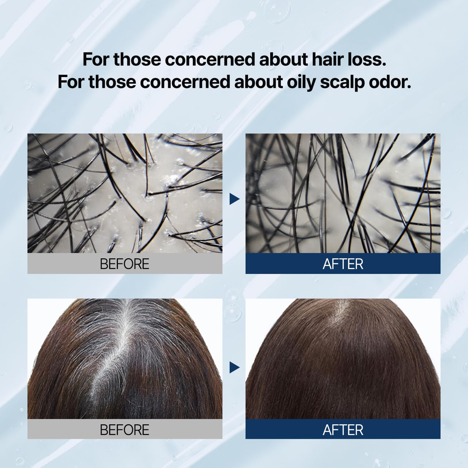 Anti Hair Loss Fast Care Hair Shampoo 16.90 fl. oz.(500ml)- Volumizing Shampoo for Damaged Thinning Hair and Hair Loss with 17 types of amino acids and protein complex | Fortifies & Strengthens Hair