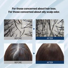 Anti Hair Loss Fast Care Hair Shampoo 16.90 fl. oz.(500ml)- Volumizing Shampoo for Damaged Thinning Hair and Hair Loss with 17 types of amino acids and protein complex | Fortifies & Strengthens Hair
