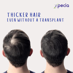 Men's DHT Blocker New Hair Growth Formula -60 Tablets