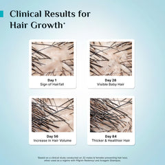 Pilgrim Redensyl 3% + Anagain 4% + Baicapil Advanced Hair Growth Serum (30ml) for Scalp with Korean Black Rice, Saw Palmetto | Control Hair Fall, Stimulate Hair Regrowth, Hair (30ml, (Pack of 1))