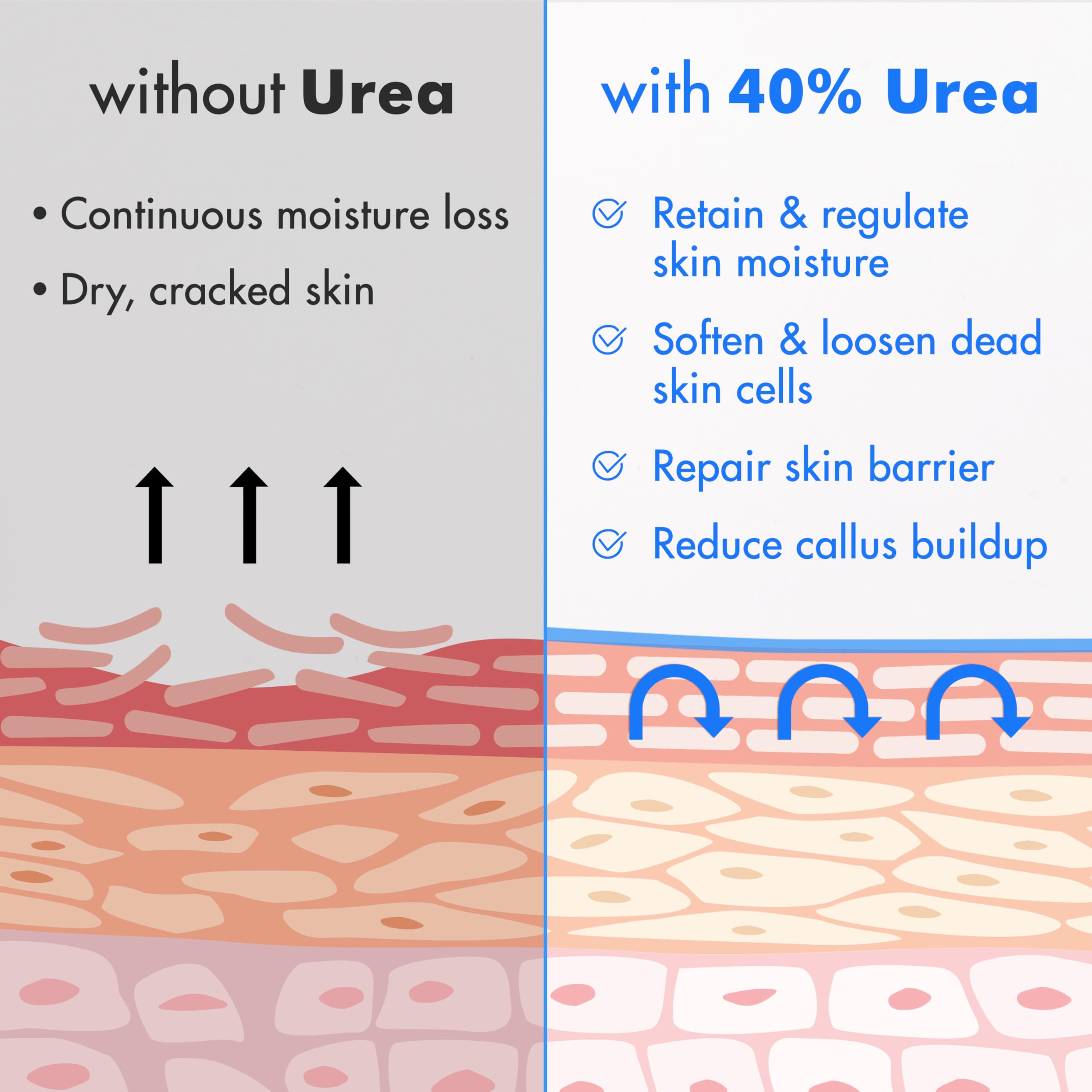 Ebanel Urea Cream 40% plus Salicylic Acid 2%, Foot Cream for Dry Cracked Feet Heels Knees Elbows Hands Repair Treatment, Foot Moisturizer Corn Callus Dead Skin Remover Toenail Softener for Feet Care