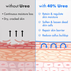 Ebanel Urea Cream 40% plus Salicylic Acid 2%, Foot Cream for Dry Cracked Feet Heels Knees Elbows Hands Repair Treatment, Foot Moisturizer Corn Callus Dead Skin Remover Toenail Softener for Feet Care