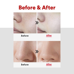 Medi-peel] Aesthe Derma Lacto Collagen Clear 300ml | Korean Facial Cleansing Foam | K-Beauty Skincare | Collagen Cleanser | Deep Cleansing | Pore Tightening | Micro Bubble