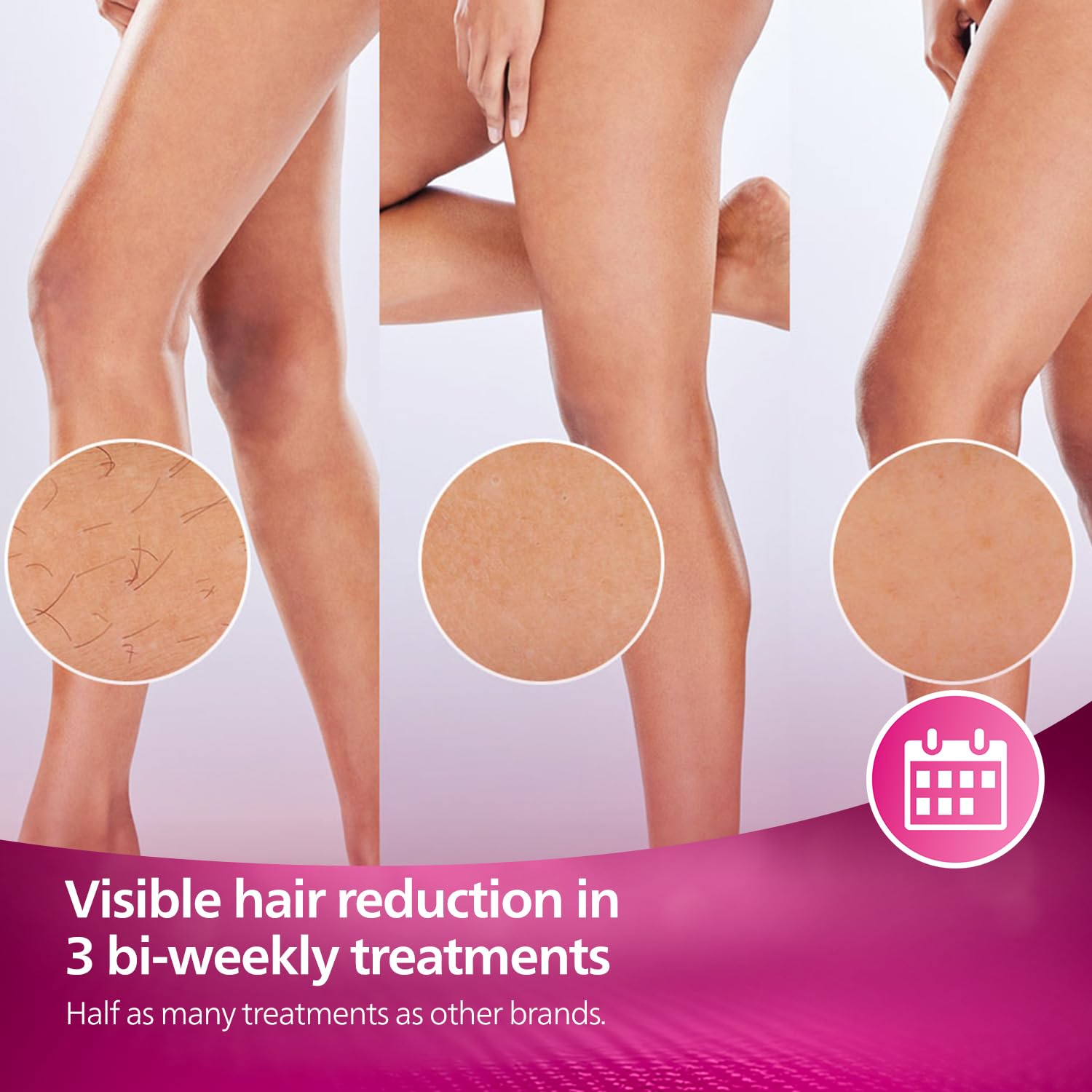 Philips Lumea IPL | Hair Removal | 7000 Series | Skintone Sensor | 2 Attachments | Body, Face | Compact Pen Trimmer | Corded Use | BRI921/60
