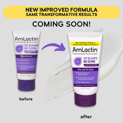 AmLactin KP Bumps Be Gone - 3 oz Keratosis Pilaris Moisturizing Cream with 15% Lactic Acid - Exfoliator and Moisturizer for Dry, Rough and Bumpy Skin (Packaging May Vary)
