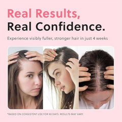 Hair Growth Oil Spray, Advanced Natural Hair Growth Oil Non-greasy, Stronger and Hair Thickening Spray, Scalp Nourishing, Damage Repair, Loss Prevention, Ideal for Dry Scalp (1pc)
