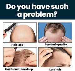 Hair Growth Serum for Hair Loss and Regrowth - 60ml*3 Ginger Solution for Men - Hair Follicle Repair Treatment