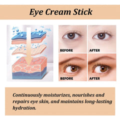 TERRIFI Eye Cream for Dark Circles, Advanced Snail Repair Eye Stick with Snail Mucin, Hydrating Cream for Puffiness and Bags Under Eyes, Reduces Fine Lines and Wrinkles (1pc)