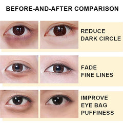 Snail Peptide Eye Serum, Mucin Eye Cream, Under Eye Roller Cream to Reduce Dark Circles Puffiness Wrinkles Fine Lines, Niacinamide Eye Essence with 360° Massage Ball, Roll-On for Moisturizing Firming