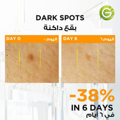 Garnier Serum for Dark Circles, Single Dose, Hyperpigmentation Ampoule, With 3% Vitamin C & Niacinamide, SkinActive Fast Bright, (1 X 1.5ml)