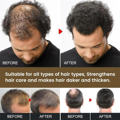Spartan Shampoo, Spartan Root Activator Shampoo, Natural Hair Growth Shampoo 100 ml, Against Hair Loss Repairing Care Shampoo, Hair Care Promotes Hair Growth Women Men