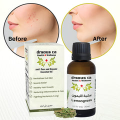 Drsous Ca Organic Lemongrass Essential Oil 30ml | 100% Cold Pressed Pure and Natural Lemongrass Oils for Diffuser, Stress Relief, Skin care and Hair care | Made in Palestine
