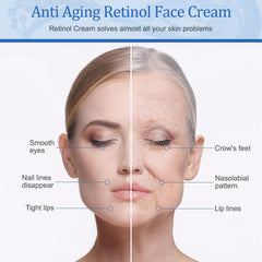 KASTWAVE Retinol Cream for Face, Day and Night Face Lotion with Hyaluronic Acid, Collagen, Face Moisturizer for Firm Skin, Fade Wrinkles, Anti Aging Face Cream for Women, Men, 50 ML