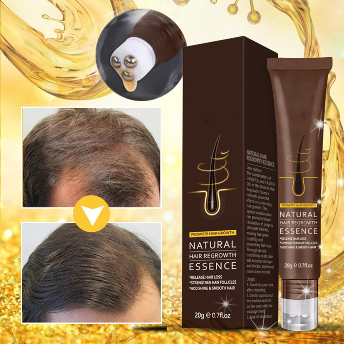 Hair Growth Serum, Anti Hair Loss Essence, Hair Regrowth Serum for Alopecia Hair Loss Treatment, Bald, Thin Hair, Self-Scalp Massager Repairs Follicles Stronger Hair For Men & Women Scalp Health