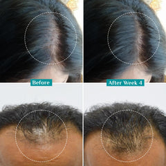 Pilgrim Redensyl 3% + Anagain 4% + Baicapil Advanced Hair Growth Serum (50ml) for Scalp with Korean Black Rice, Saw Palmetto | Control Hair Fall, Stimulate Hair Regrowth, Hair (50ml)