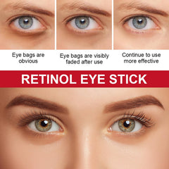 KASTWAVE 2Pcs Retinol Eye Stick, Retinol Eye Cream for Dark Circles Puffiness Under Eye Bags Fine Lines Wrinkles