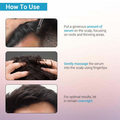 Sotrue Hair Growth Serum With Redensyl 3%, Procapil 3%, Anagain 4% and Baicapil 2% Hair Growth Actives, Stimulates Hair Growth, Hair Fall Control Serum For Women & Men, For All Hair Types, 30ml