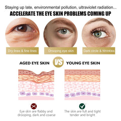 Snail Peptide Eye Serum, Mucin Eye Cream, Under Eye Roller Cream to Reduce Dark Circles Puffiness Wrinkles Fine Lines, Niacinamide Eye Essence with 360° Massage Ball, Roll-On for Moisturizing Firming