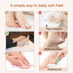 ALIVER Foot Peel Mask 5 Packs, Exfoliating Foot Mask for Soft Baby Feet Repair Heels & Removes Dry Dead Skin Feet Peeling Socks Foot Treatment for Hard Skin