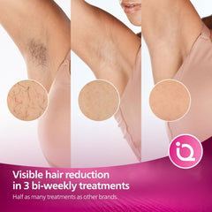 Philips Lumea IPL | Hair Removal | 7000 Series | Skintone Sensor | 2 Attachments | Body, Face | Compact Pen Trimmer | Corded Use | BRI921/60