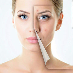 German ZGTS Micro Needle Derma Roller 0.5 mm Facial Treatment
