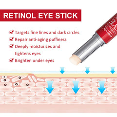 KASTWAVE 2Pcs Retinol Eye Stick, Retinol Eye Cream for Dark Circles Puffiness Under Eye Bags Fine Lines Wrinkles