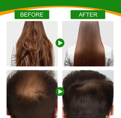 ALIVER Batana Oil for Hair Growth Cold Press 120ml with Derma Roller - 100% Pure & Natural Batana Oil, Eliminate Hair Split Ends, Damaged Hair Repair,Enhances Hair & Skin Radiance Nourishment