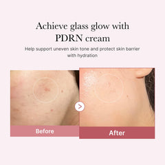 medicube Salmon DNA PDRN Pink Hyaluronic Moisturizing Cream, Pink Soothing Cream, Hyaluronic acid, Niacinamide, Hydrating & Firming, Uneven Skin Tone, Pore Care, Korean Skincare | (50ml/ 1.69 fl.oz.)