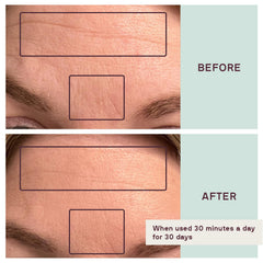 Dermaclara Silicone Forehead Wrinkle Patch - Silicone Fusion Treatment Forehead Patches for Wrinkles & Fine Lines - Anti-Wrinkle, Facial Patches - Pregnancy Safe SkinCare - Reusable up to 30 Times