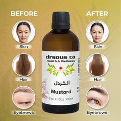 Drsous Ca Organic Mustard Oil 100ml | 100% Cold Pressed Therapeutic Grade Massage Oil for Skin care, Hair care, Cold and Cough Relief, Reducing Gum Swelling | Made in Palestine