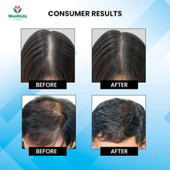 Rosemary Water Shampoo, Anti-Hairfall, Thickens & Strengthens Hair, Paraben-Free, 200ml
