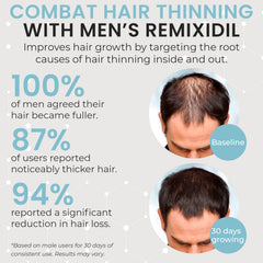 Remixidil Growth Supplements for Men | & Beard Growth Vitamins | Clinically Tested for Thicken & Strengthen | Fast-Acting Supplement for Boosting Volume | 60 Capsules