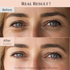 Beauty Eye Serum, Daily Eye Serum with Retinal Niacinamide Correction, Under-eye Firming Serum for Puffy Eye Bags Fine Lines Dark Circles Wrinkles, Anti Aging Eye Skin Care 30ml, 1 fl.oz (Pink)