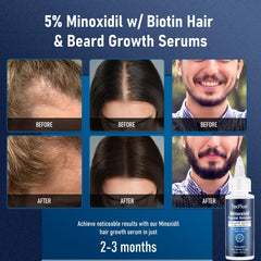 5% Minoxidil for Men & Women Hair with Biotin, Minoxidil for Men Beard,Tecflox Minoxidil Beard Growth Oil, Minoxidil Hair Growth Serum, 2-Pack, Total 4fl oz for 4 Months, Hair Growth Oil Unisex