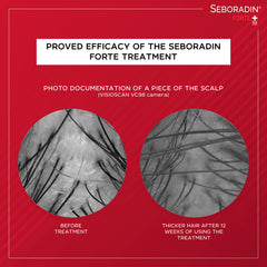 Seboradin Forte Shampoo Against Hair Loss, Thinning, and for Growth - Vitamins and Natural Extracts for Scalp Care - For Women and Men - 400 ml