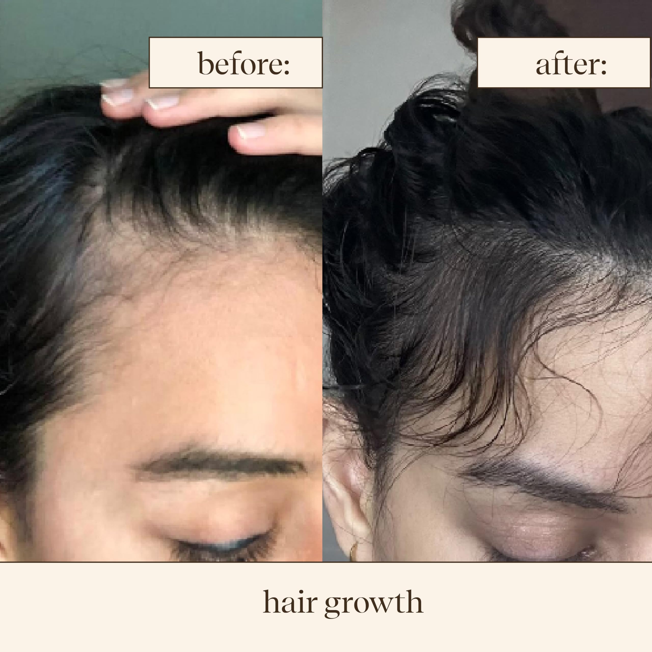 indē wild Moonlight Overnight Scalp Serum - 50ml | Advanced Ayurvedistry™ | Scalp Treatment for Hair Density | Infused with 3% Redensyl, 3% Procapil and 3% Baicapil | For all hair types