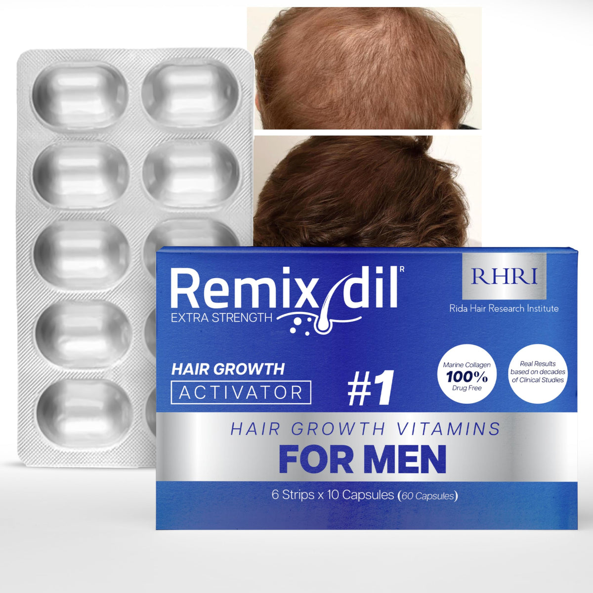 Remixidil Growth Supplements for Men | & Beard Growth Vitamins | Clinically Tested for Thicken & Strengthen | Fast-Acting Supplement for Boosting Volume | 60 Capsules