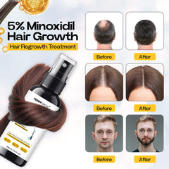 5% Minioxidil, Hair Growth Serum, Regrowth Treatment For Thickens Hair,Promotes Hair Density Help to Stop Thinning loss stimulates Hair Growth, Regain Hair Serum with Biotin (180 ml (pack of 3))