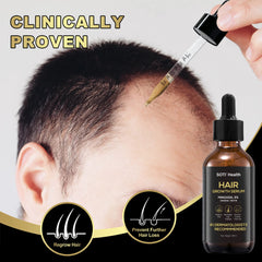 5% Minoxidil Hair Growth Serum for Hair Loss & Thinning, with Ginseng, Fo-Ti, Biotin – Thicker, Stronger Hair Regrowth & Fuller Appearance Scalp Health Treatment, 6-Month Supply (360 ml)