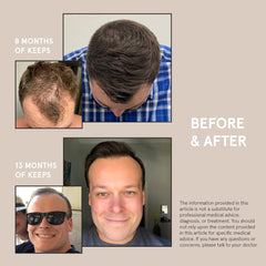 Keeps Hair Thickening Conditioner for Fuller, Thicker Looking Hair, 8 Ounces - Hair Loss, Thinning & Regrowth Treatment - DHT Blocker for Men - Infused with Biotin, Caffeine, & Saw Palmetto