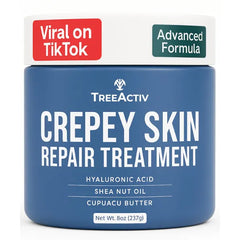 TreeActiv Crepey Skin Repair Cream Original Formula, 8 fl oz, Firming Cream For Face & Neck, Skin Firming Lotion with Hyaluronic Acid, Crepey to Address Dry Crepe