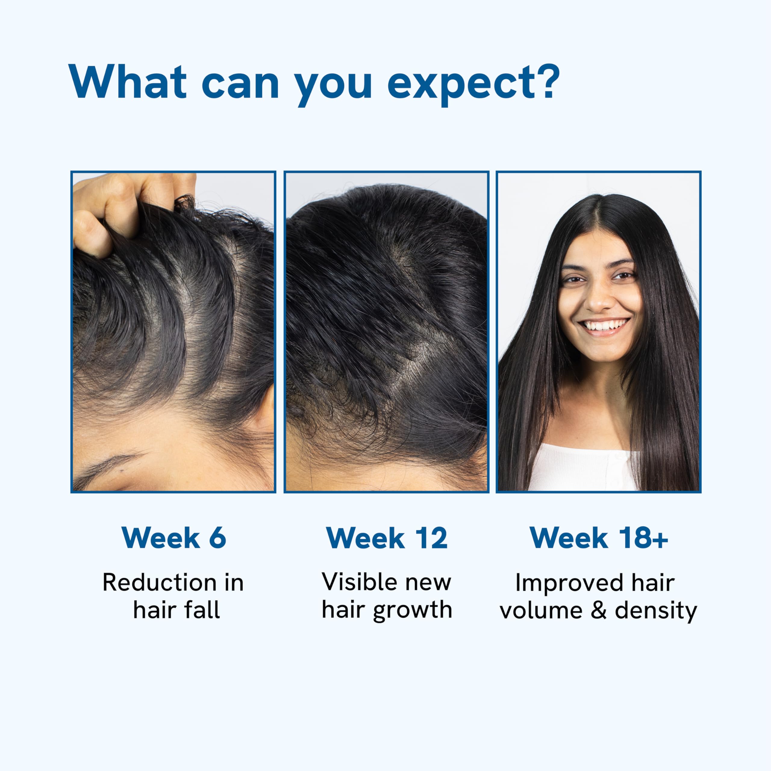 Be Bodywise 3% Rosemary Hair Growth Serum (Roll On) | 3% Redensyl, 2% Aminexil & 2% Anagain | Thicker & Stronger Hair | Prevents Hair Fall & Stimulates Follicles | 25ml
