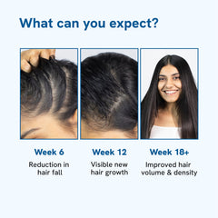 Be Bodywise 3% Rosemary Hair Growth Serum (Roll On) | 3% Redensyl, 2% Aminexil & 2% Anagain | Thicker & Stronger Hair | Prevents Hair Fall & Stimulates Follicles | 25ml