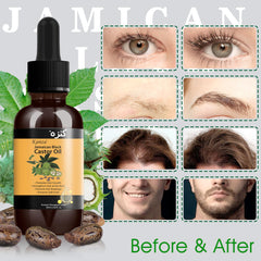 KANZA - Rosemary Essential Oil & Castor Oil for Hair Growth (60ml*2) | Jamaican Black Castor Oil, Hair Growth Serum| Anti Hair Loss Serum|Organic Castor Oil,Rosemary Oil for Hair Growth for Men&Women