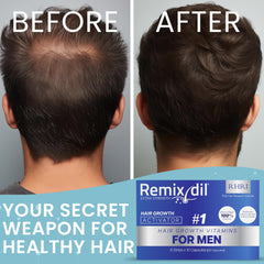 Remixidil Growth Supplements for Men | & Beard Growth Vitamins | Clinically Tested for Thicken & Strengthen | Fast-Acting Supplement for Boosting Volume | 60 Capsules